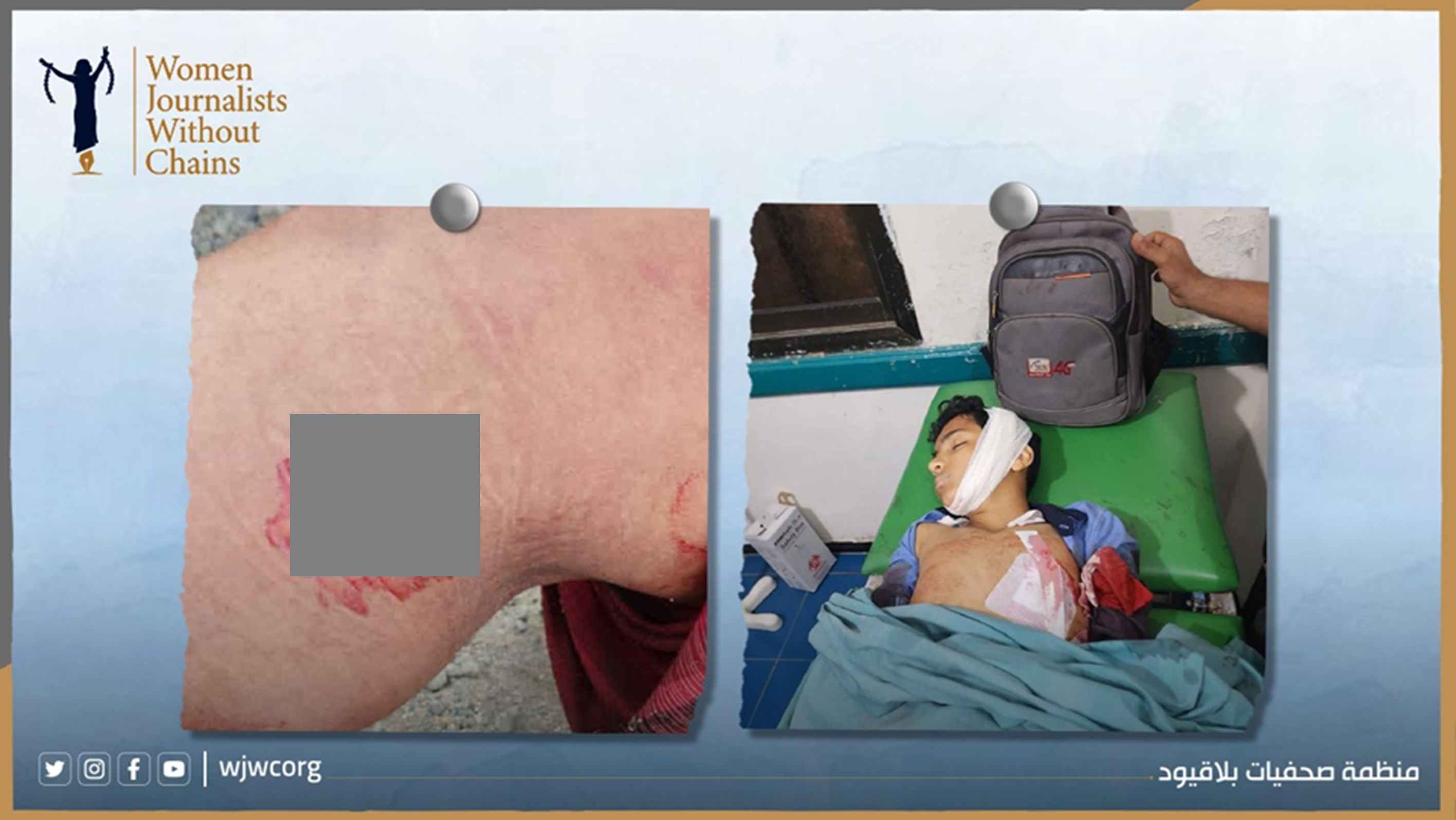 Systematic Houthi Sniper Attacks on Civilians in Taiz Amount to War Crimes